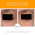 730629---Creme-para-area-dos-Olhos-Neostrata-Brightening-Eye-Cream-15g_0002_732013301194_7