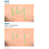 865940---Serum-Facial-Antirrugas-Skinceuticals-P-Tiox-30ml_0017_SCK_ECOMM_PTIOX_07.png