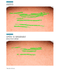 865940---Serum-Facial-Antirrugas-Skinceuticals-P-Tiox-30ml_0018_SCK_ECOMM_PTIOX_06.png