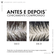 855570---Shampoo-Anticaspa-Vichy-Dercos-DS-300g_0005_0.png
