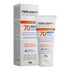 832472-Protetor-Solar-Facial-Helioderm-FPS70-Oil-Free-Ativo-Hialuronico-50g-1.jpg