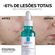 807320---Serum-La-Roche-Posay-Ultra-Concentrado-Effaclar-30ml-5