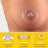 Protetor-de-Mamilo-de-Silicone-Medela-G-24mm-2-Unidades-Pacheco-722685-2