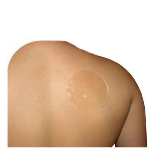 9010419---disco-skingel-10-cm-sg-201-ortho-pauher 9010419---disco-skingel-10-cm-sg-201-ortho-pauher